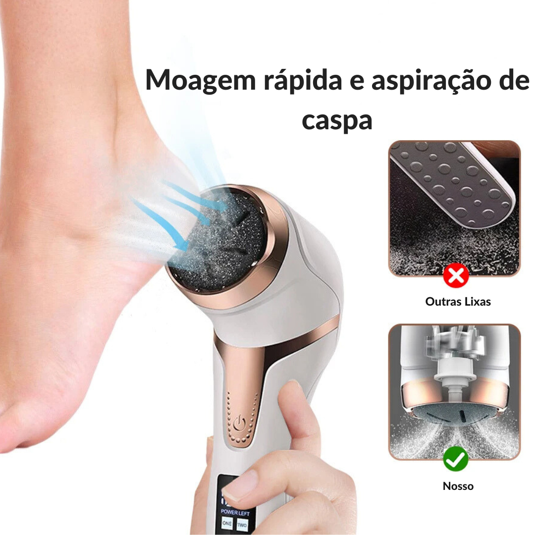 Removedor Elétrico de Calos e Rachaduras OrtoLive