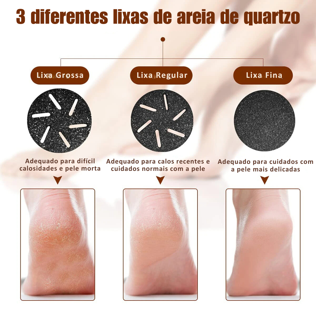 Removedor Elétrico de Calos e Rachaduras OrtoLive