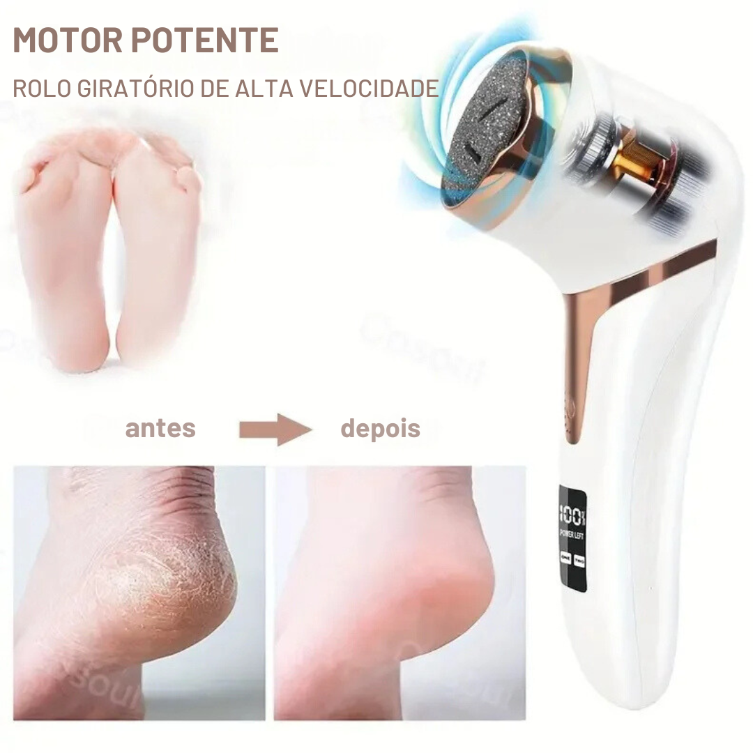 Removedor Elétrico de Calos e Rachaduras OrtoLive